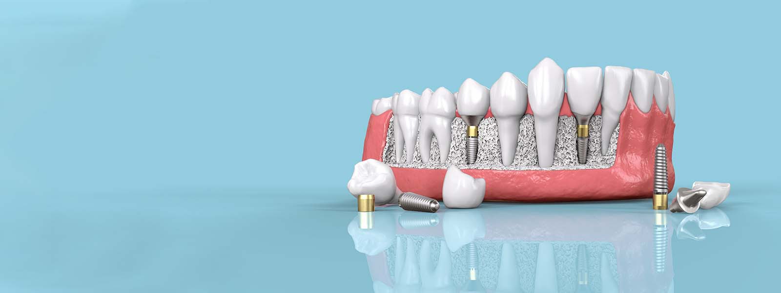 We are the #1 rated provider of a wide range of oral health care services in Manhattan 
View More